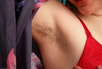 ATK hairy Urtica Set