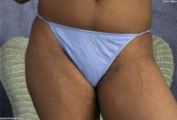 ATK hairy Valeria Set