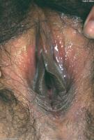 ATK hairy  in exotic and hairy