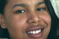 ATK hairy  in exotic and hairy