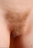 ATK hairy  in mature and hairy