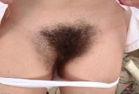 ATK hairy  in mature and hairy