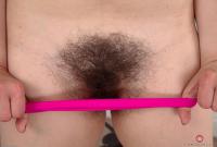 ATK hairy  in mature and hairy