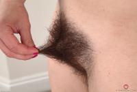 ATK hairy  in mature and hairy