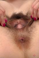 ATK hairy  in mature and hairy