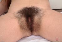 ATK hairy  in mature and hairy