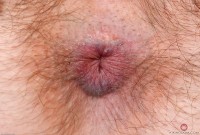 ATK hairy  in hairy fun