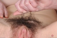 ATK hairy  in mature and hairy