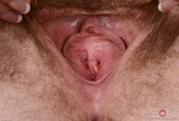 ATK hairy  in mature and hairy