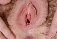 ATK hairy  in mature and hairy