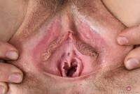 ATK hairy Rose Vermillion Set