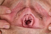 ATK hairy Rose Vermillion Set