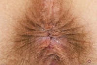 ATK hairy Veronica Rose Set
