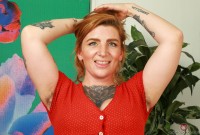 ATK hairy  in mature and hairy