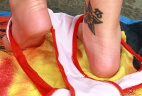 ATK hairy  in mature and hairy