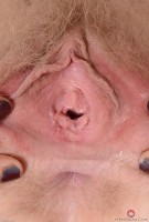 ATK hairy  in hairy fun