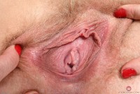 ATK hairy  in young and hairy