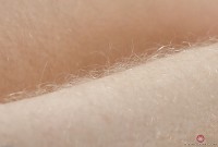 ATK hairy  in young and hairy