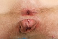 ATK hairy  in young and hairy