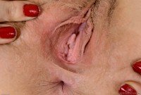 ATK hairy  in young and hairy