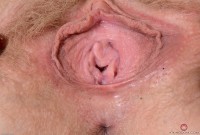ATK hairy  in young and hairy