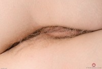 ATK hairy  in young and hairy