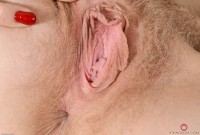 ATK hairy  in young and hairy