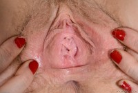 ATK hairy  in young and hairy