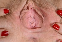 ATK hairy  in young and hairy