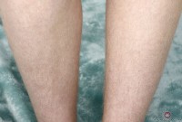 ATK hairy Vestacia JonQuil Set