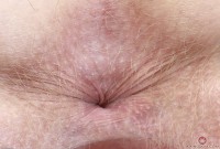 ATK hairy Vestacia JonQuil Set