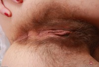 ATK hairy  in mature and hairy