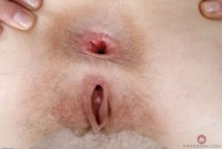 ATK hairy  in young and hairy