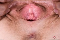 ATK hairy  in young and hairy