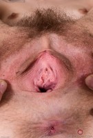 ATK hairy  in young and hairy