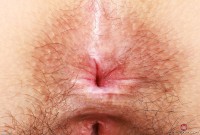 ATK hairy  in young and hairy