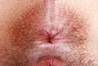 ATK hairy Violet Viper Set