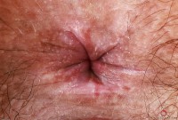 ATK hairy Violet Viper Set