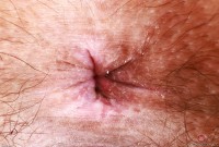 ATK hairy Violet Viper Set