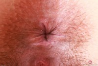 ATK hairy  in young and hairy