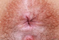 ATK hairy Violet Viper Set