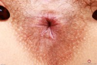 ATK hairy  in young and hairy