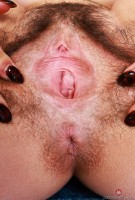 ATK hairy  in young and hairy