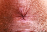 ATK hairy  in young and hairy