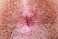 ATK hairy Violet Viper Set