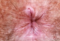 ATK hairy Violet Viper Set