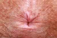 ATK hairy Violet Viper Set