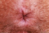 ATK hairy Violet Viper Set