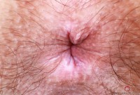 ATK hairy Violet Viper in young and hairy