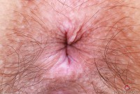 ATK hairy Violet Viper Set